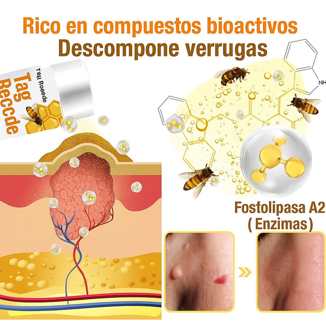 🐝 ⭐⭐⭐⭐⭐ REMOVEDOR PARA VERRUGAS Y LUNARES🐝👨⚕