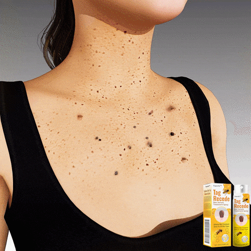 🐝 ⭐⭐⭐⭐⭐ REMOVEDOR PARA VERRUGAS Y LUNARES🐝👨⚕